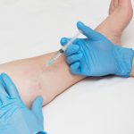 varis-tedavisi-etkenler